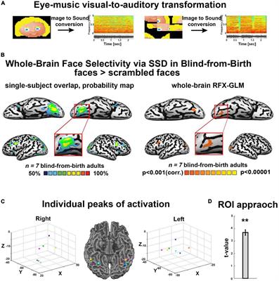 Face shape processing via visual-to-auditory sensory substitution activates regions within the face processing networks in the absence of visual experience